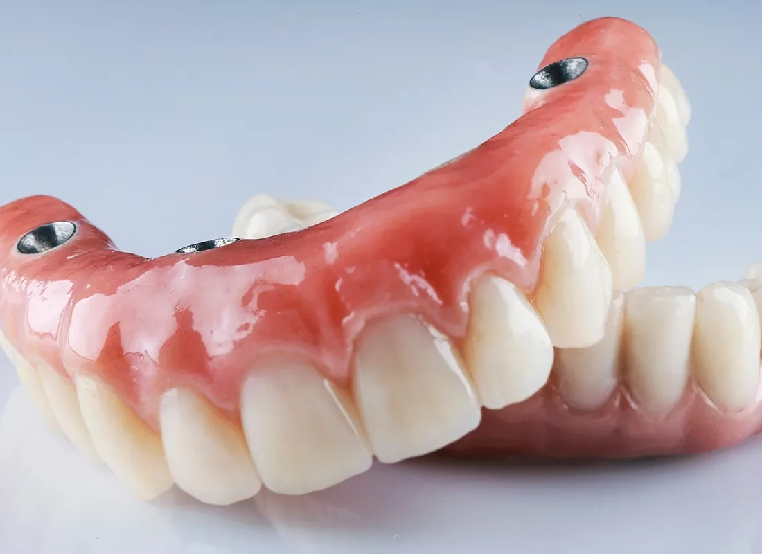 What Should You Expect During the Process of Getting Dentures?