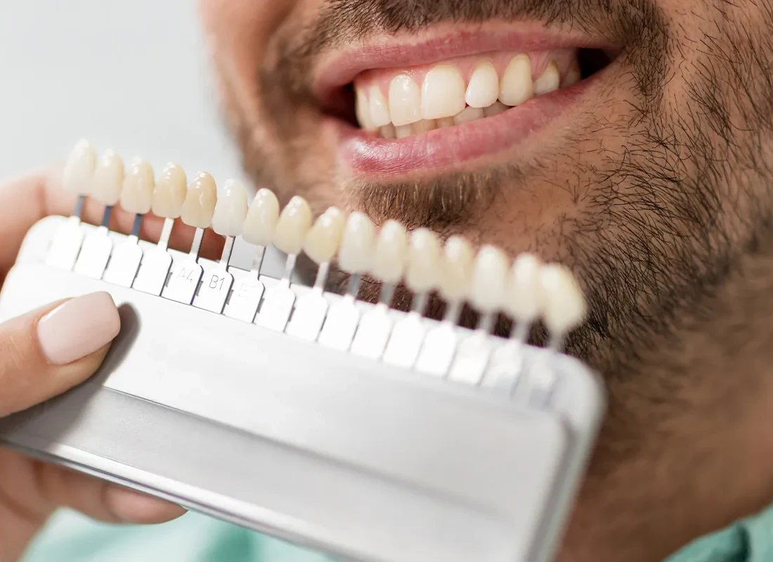 The Long-Term Benefits of Professional Teeth Whitening Beyond a Brighter Smile