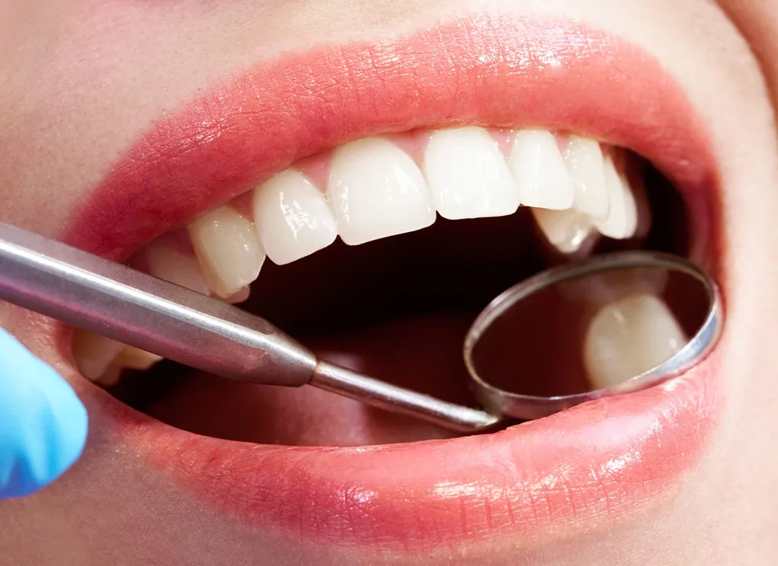 What is Dental Exams & Digital X-Rays