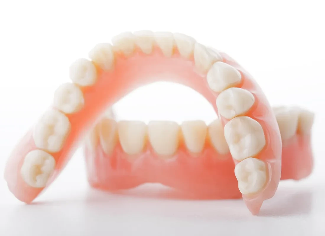 What is Overdentures