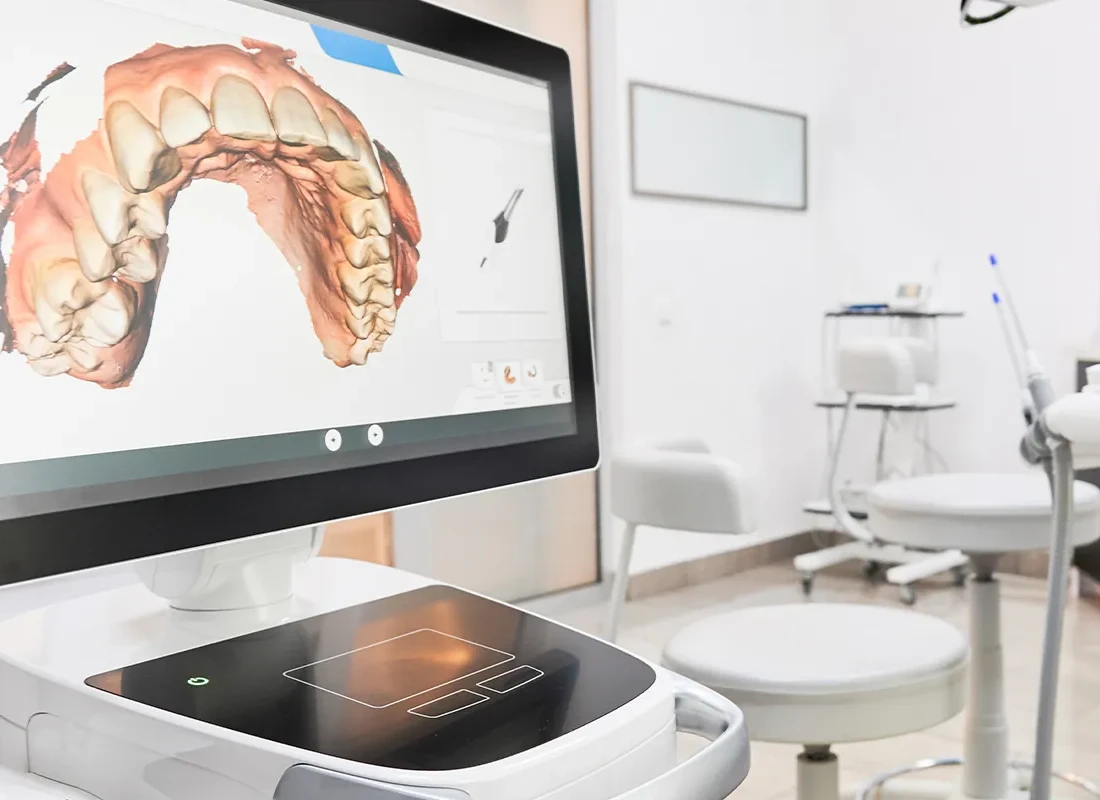 Full Mouth Rehabilitation