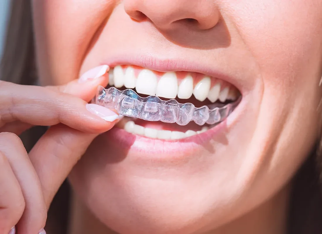 What is TMJ Treatment