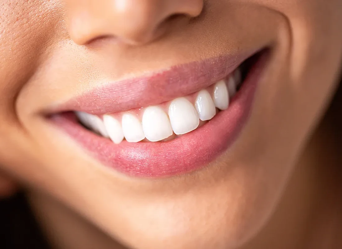 What is Full Mouth Rehabilitation