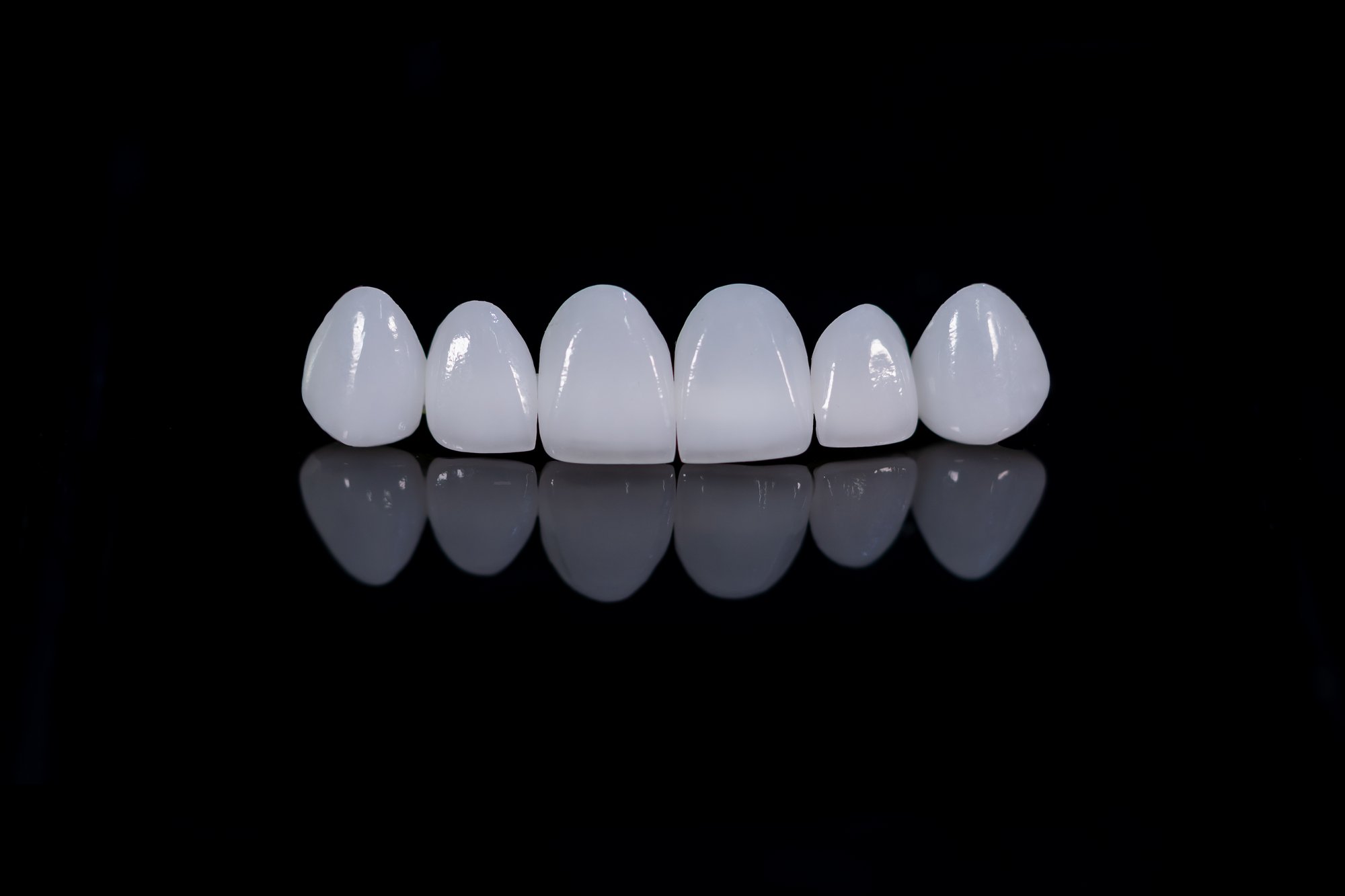 Can Veneers Fix Gaps and Chips at Once?